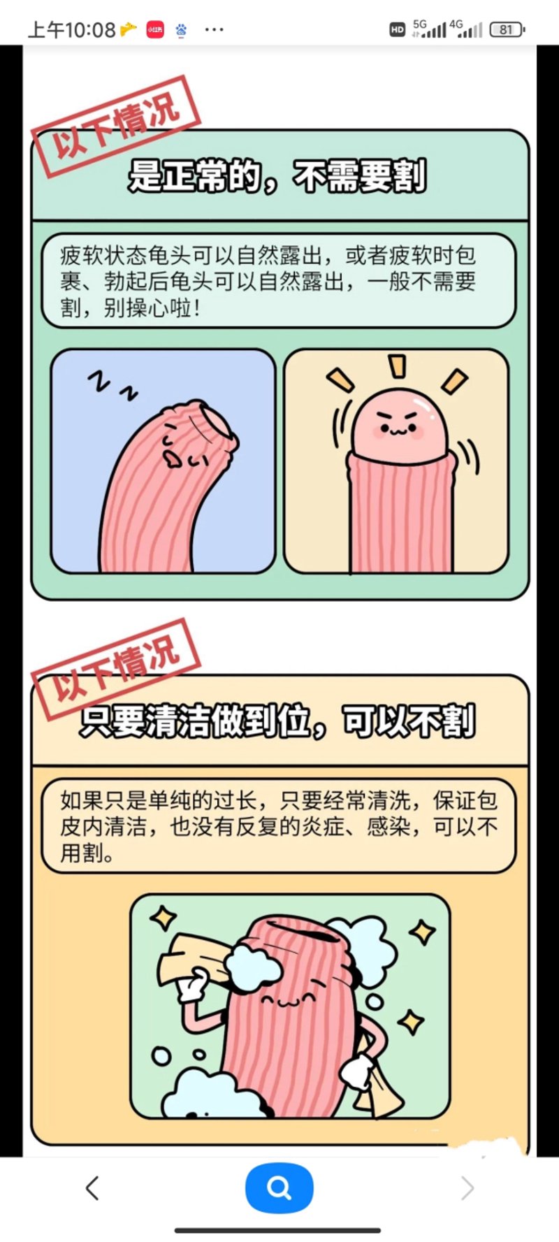 包皮环切