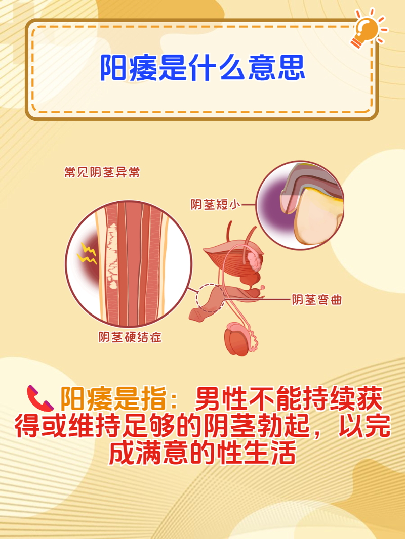 泌尿系结石：不同类型的分类与区别