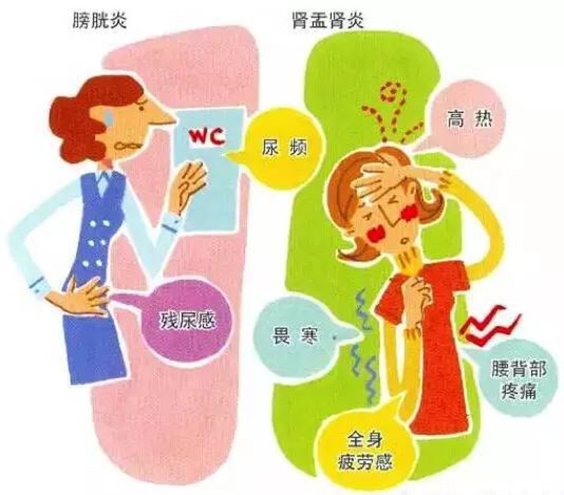 泌尿系结石如何分类？五洲专家带你了解！